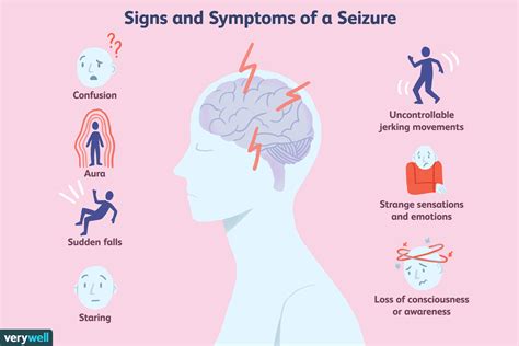 What Causes Epilepsy Seizures In Humans